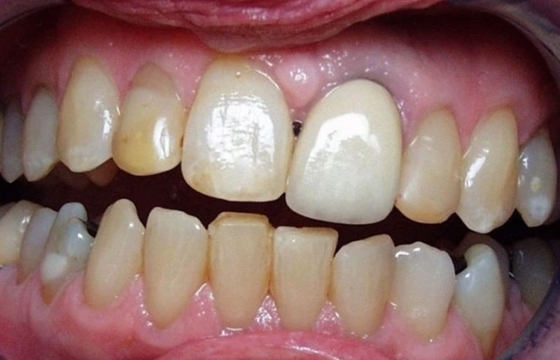 Teeth Image
